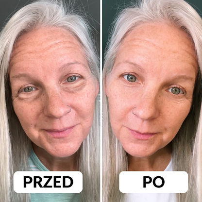 Solevi Eyepods - nakładki pod oczy z czerwonym światłem i mikroprądami