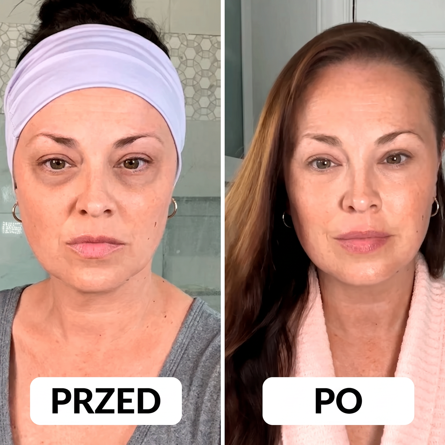 Solevi Eyepods - nakładki pod oczy z czerwonym światłem i mikroprądami