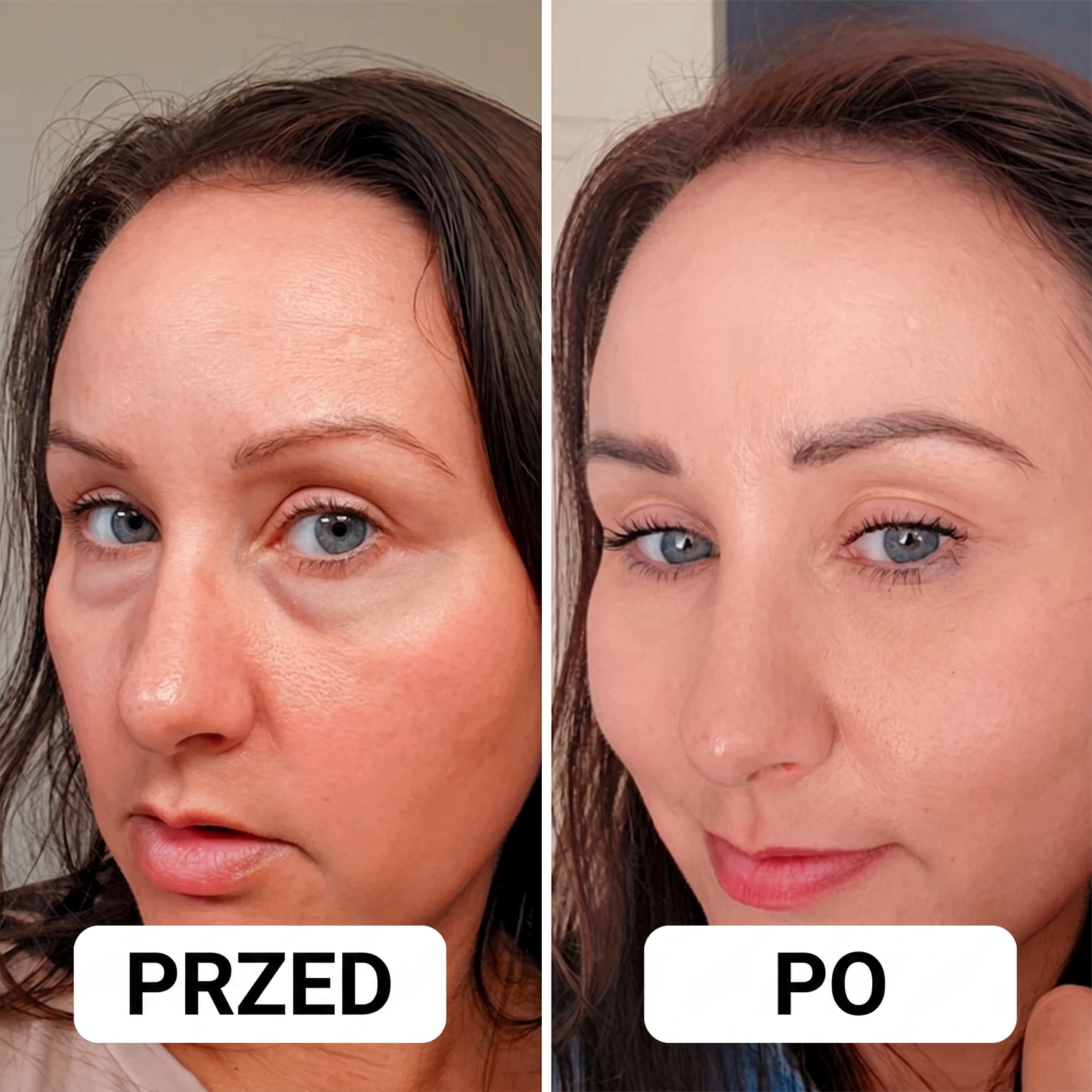 Solevi Eyepods - nakładki pod oczy z czerwonym światłem i mikroprądami